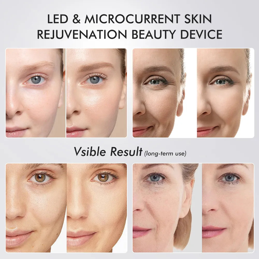 Age Booster Pro – Advanced LED Skin Rejuvenation Device